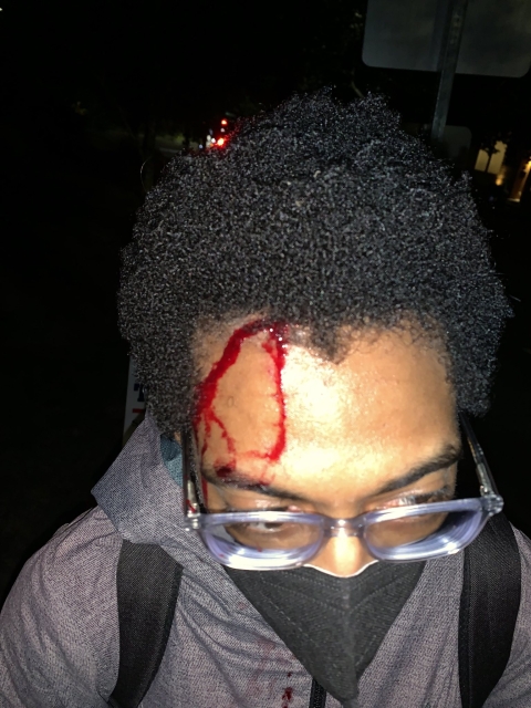 Black male with a head laceration